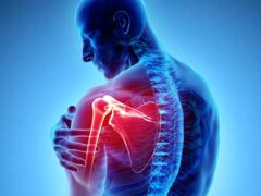SHOULDER PAIN