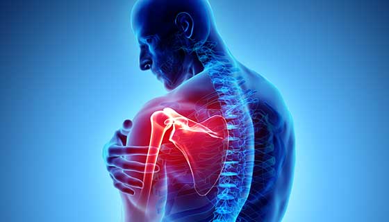 SHOULDER PAIN